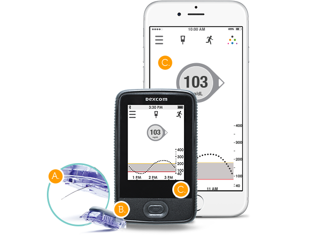 Dexcom G5 Mobile CGM System | continuous glucose monitoring on your smart device